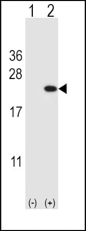 Polyclonal Rabbit anti-Human CFL1 / Cofilin Antibody (aa70-98, WB)