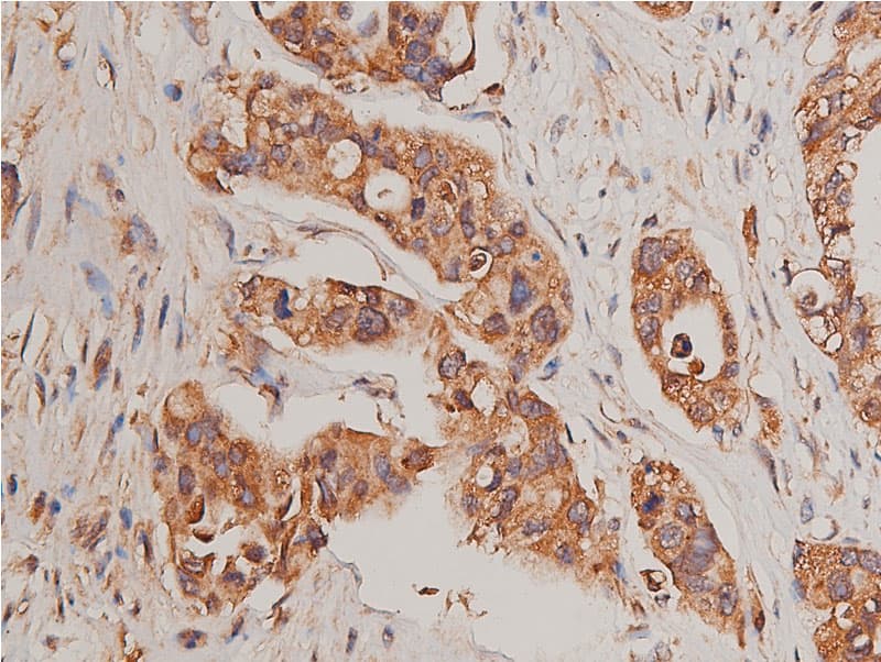 Polyclonal Rabbit anti-Human CYP17 / CYP17A1 Antibody (IHC, IF, WB)