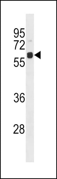 UBQLN4 Antibody (aa1-30)