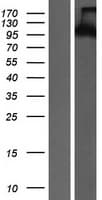 PTK2B / PYK2 Protein (Over-Expression Lysate Myc-DDK (Flag))