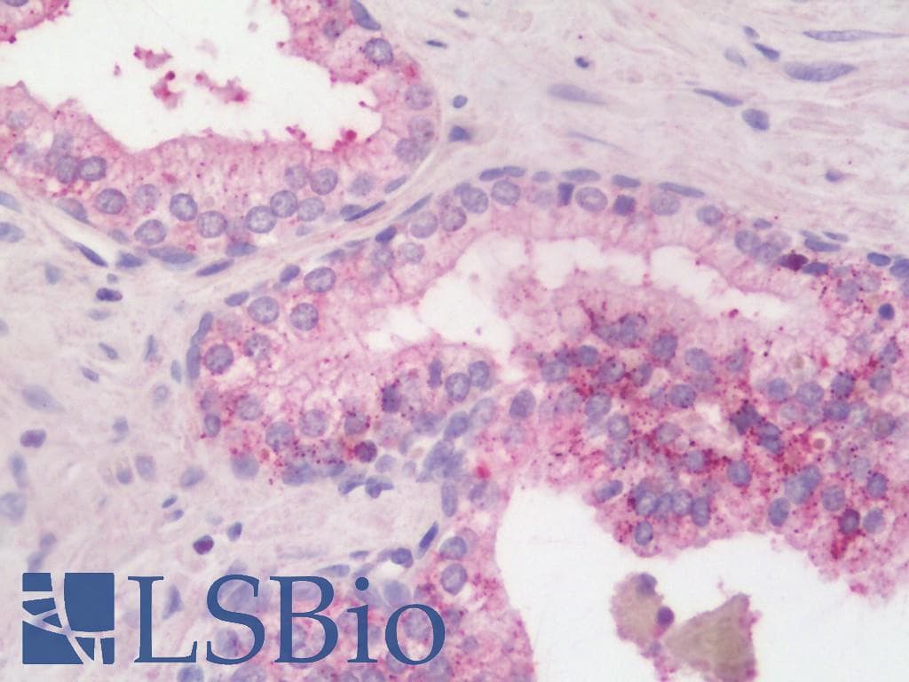 IHC-plus™ Polyclonal Rabbit anti-Human ARG2 / Arginase 2 Antibody (aa180-348, IHC, WB)