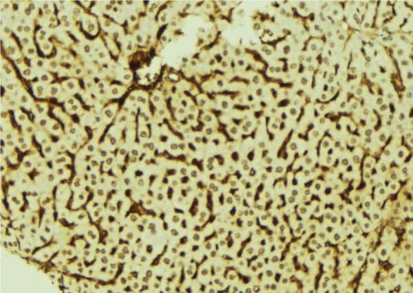 Polyclonal Rabbit anti-Human DYRK3 Antibody (IHC, WB)