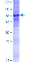 Human MAGEA2B Protein (Recombinant GST)