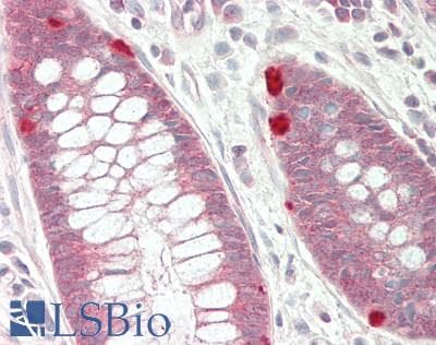 IHC-plus™ EIF4E Antibody