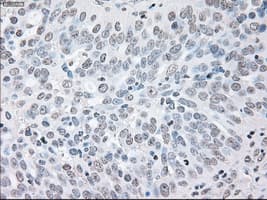 BRAF / B-Raf Antibody (clone OTI1G8)
