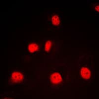 GATA1 Antibody (Internal)
