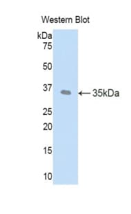 LEFTYB / LEFTY1 Antibody (aa78-361)