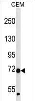 ZNF443 Antibody (aa36-64)