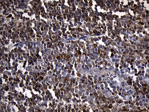 PDCL3 Antibody (clone OTI10A6)