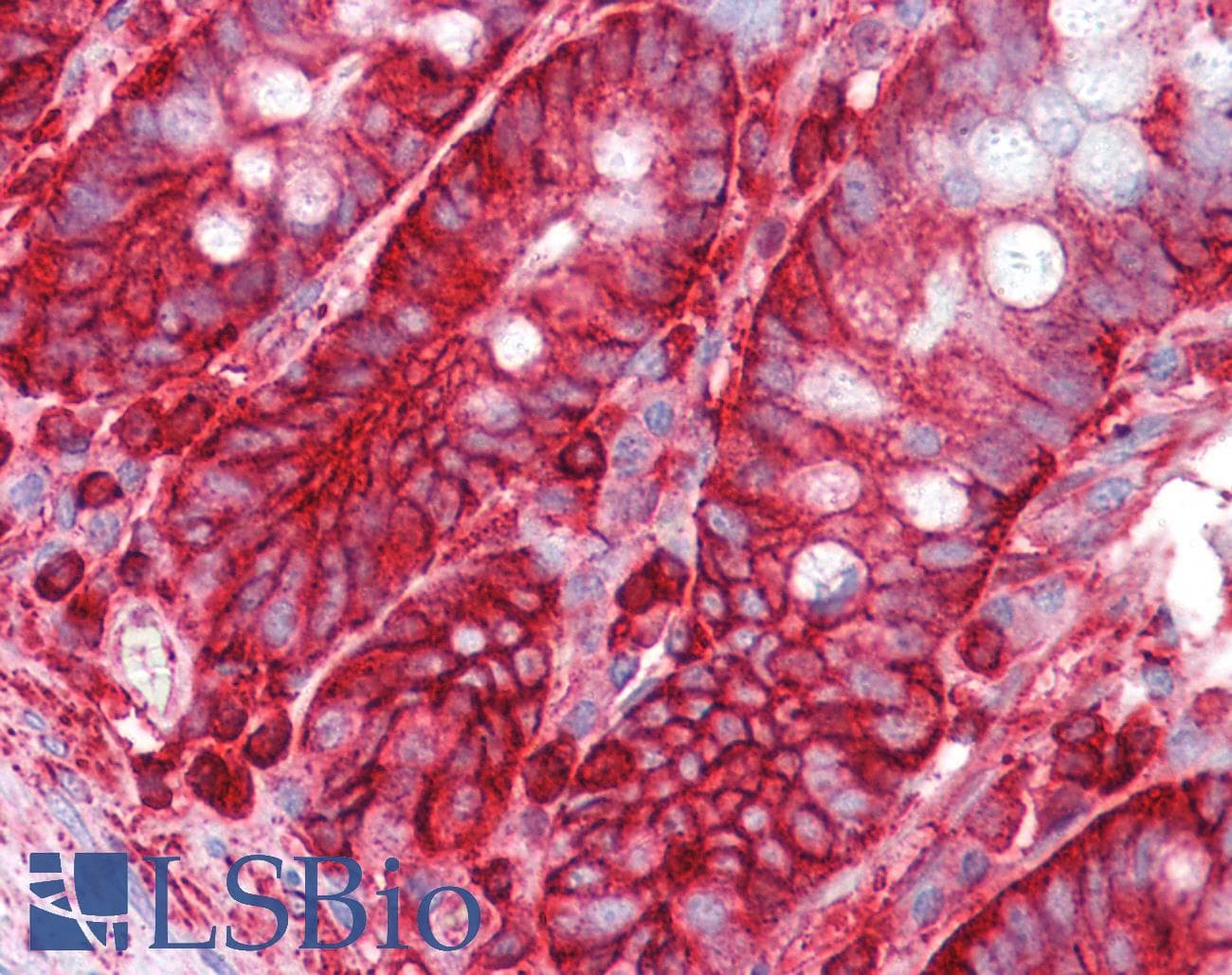 IHC-plus™ Polyclonal Rabbit anti-Human LRRTM4 Antibody (IHC, IF, WB)