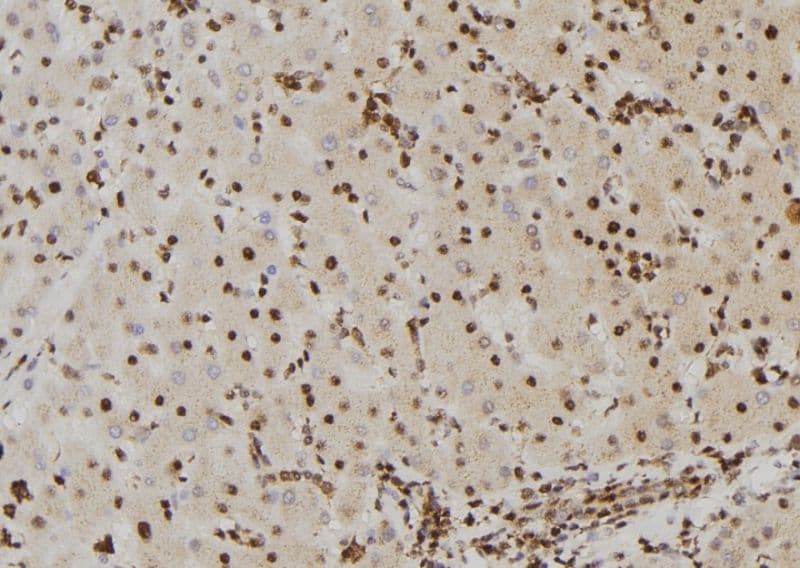 BRAF / B-Raf Antibody (phospho-Ser446)