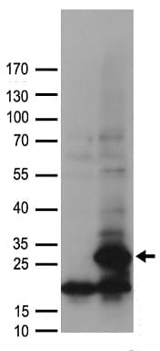 Polyclonal Rabbit anti-Human POLR2G / RPB7 Antibody (WB)