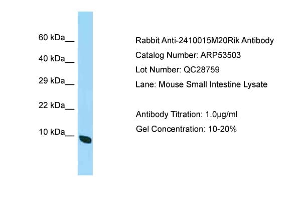 C19orf70 / QIL1 Antibody (aa63-112)