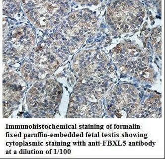 IHC-plus™ FBXL5 / FBL5 Antibody (aa510-691)