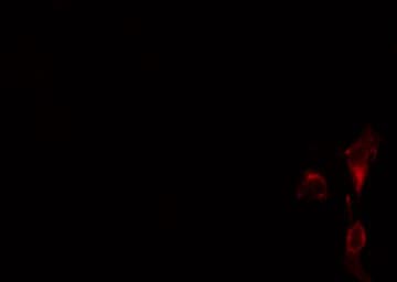 Polyclonal Rabbit anti-Human SLC9A9 / NHE9 Antibody (IF, WB)