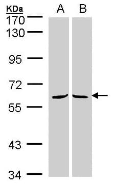 Polyclonal Rabbit anti-Human MPP3 Antibody (aa270-585, IHC, WB)
