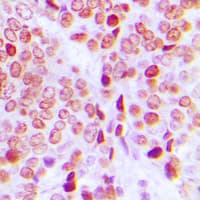 ERF / PE2 Antibody (C-Terminus)