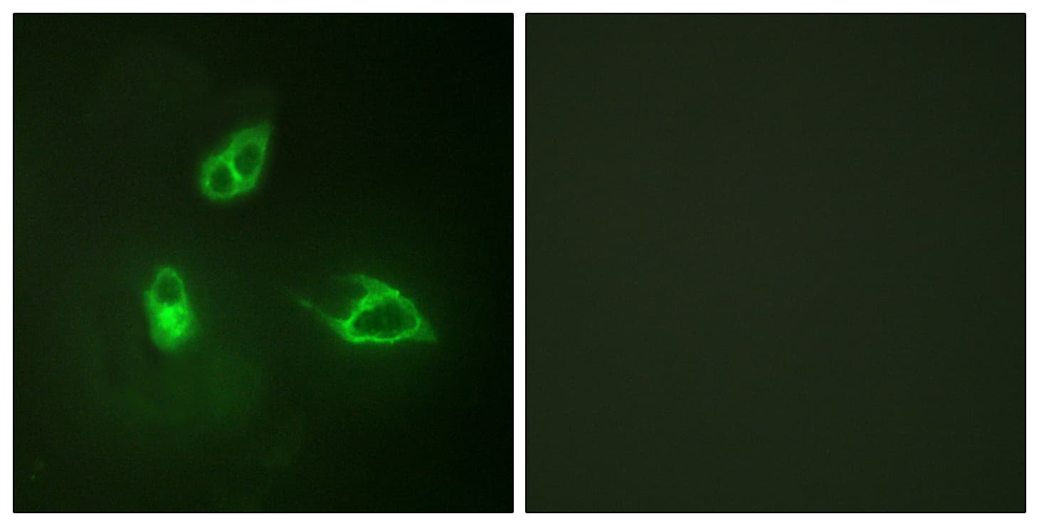 CXCR2 Antibody (aa311-360)