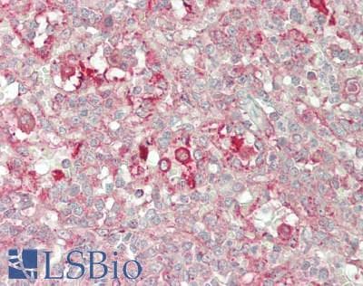 IHC-plus™ FXN / Frataxin Antibody