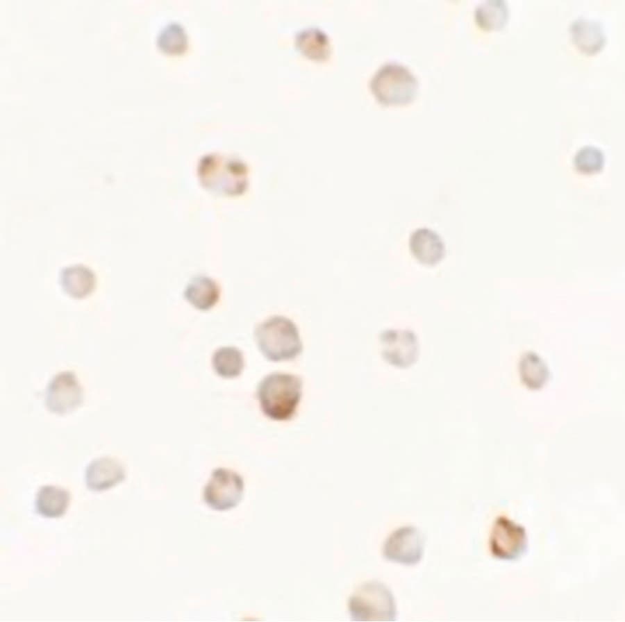 Polyclonal Rabbit anti-Human HTTY1 / TTYH1 Antibody (WB)
