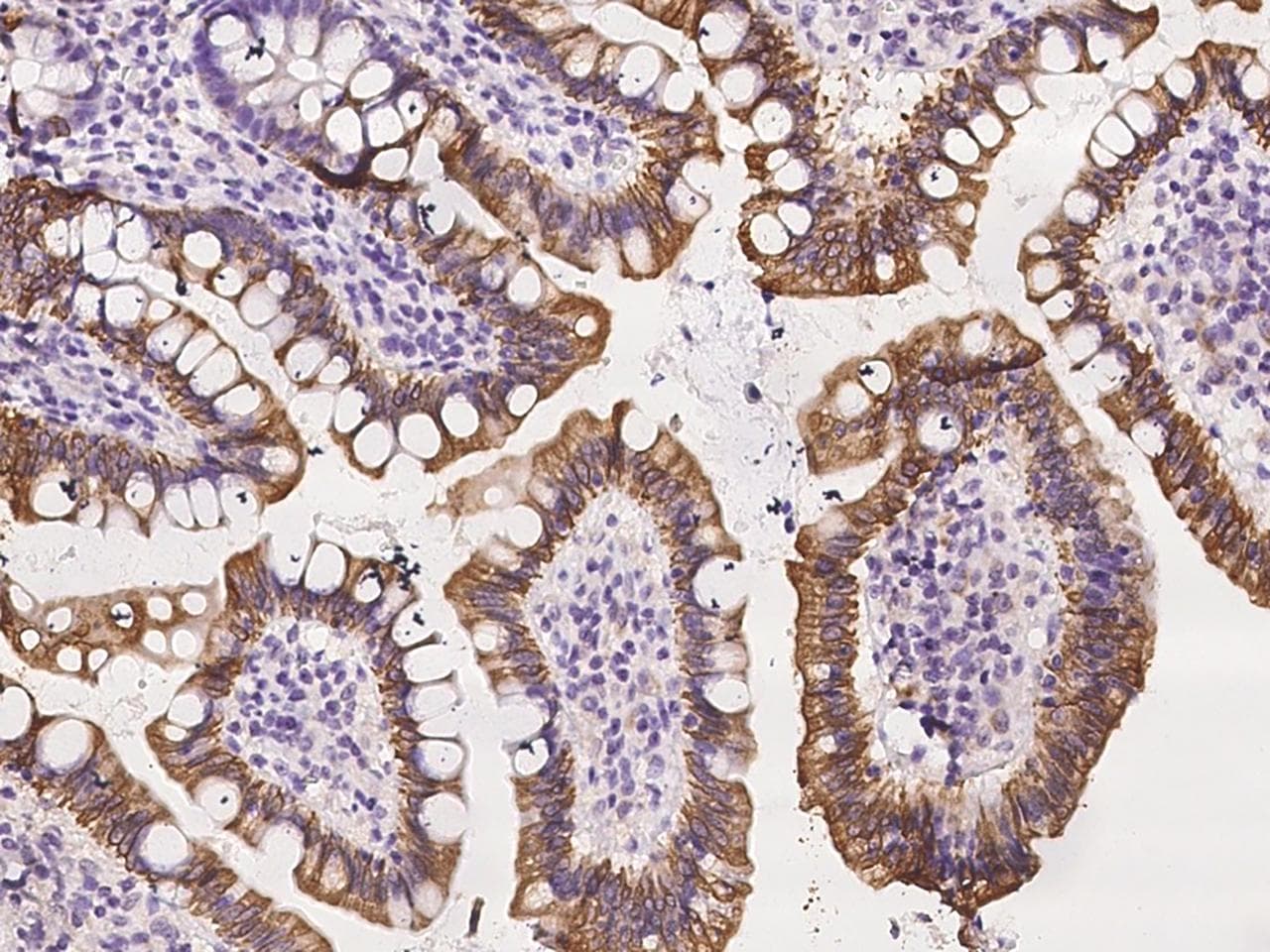 NUSAP1 / NUSAP Antibody