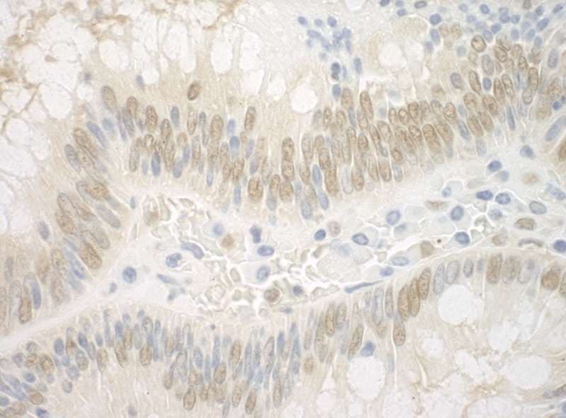IHC-plus™ ARNT / HIF-1-Beta Antibody (aa575-625)