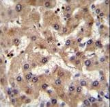 Polyclonal Rabbit anti-Human PRAMEF6 Antibody (aa395-423, IHC, IF, WB)