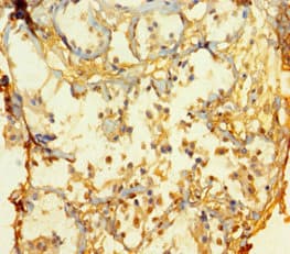 ATOH1 / MATH-1 Antibody (aa1-354)
