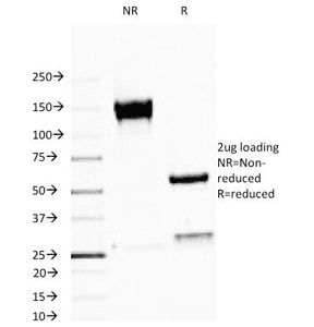 EMA / MUC1 Antibody (clone MUC1/520, Ready-to-Use)