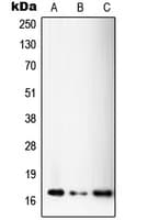 Polyclonal Rabbit anti-Human SSBP1 / mtSSB Antibody (C-Terminus, IHC, IF, WB)