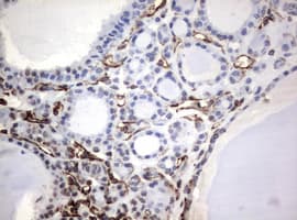 Monoclonal Mouse anti-Human Vimentin Antibody (clone OTI5D7, IHC, WB)