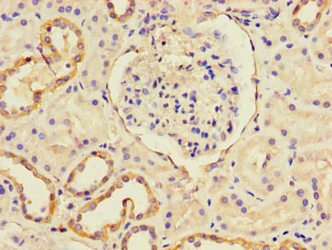Polyclonal Rabbit anti-Human CXCL11 Antibody (IHC, IF)