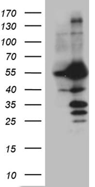 Monoclonal Mouse anti-Human PPP3CB Antibody (clone OTI2E4, aa23-96, WB)