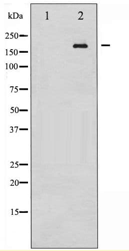 EGFR Antibody (phospho-Tyr1172)