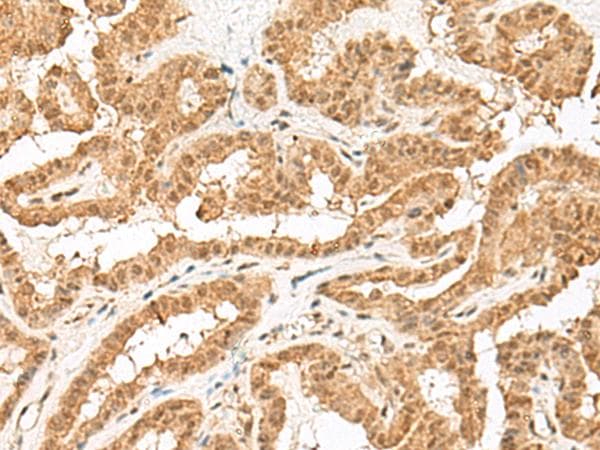 zinc finger and BTB domain containing 8 Antibody