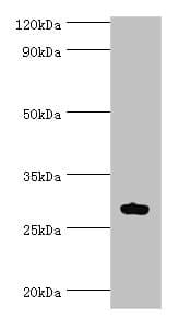 Polyclonal Rabbit anti-Human ATF1 Antibody (aa1-210, IHC, WB)