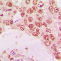 Polyclonal Rabbit anti-Human HDAC10 Antibody (N-Terminus, IHC, IF, WB)