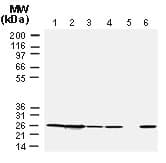 Polyclonal Rabbit anti-Human BCL2 / Bcl-2 Antibody (aa41-54, IHC, WB)