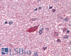 PathPlus™ CHRM3 / M3 Antibody (C-Terminus)