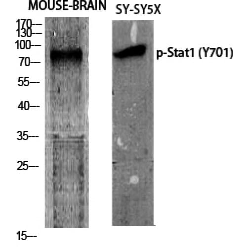 STAT1 Antibody (640-720 aa)