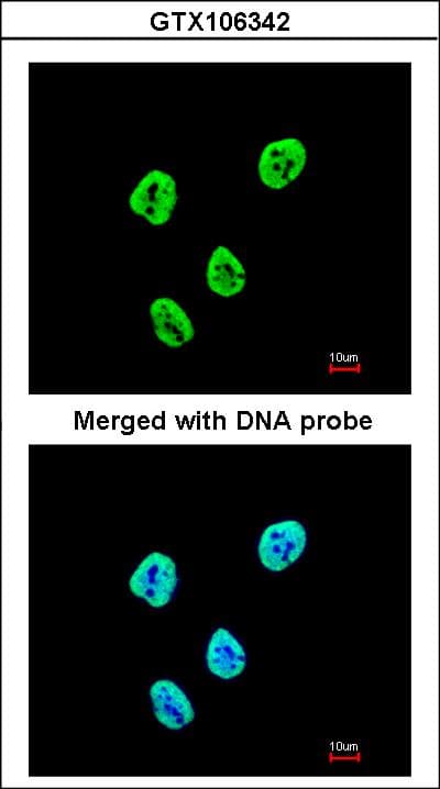 Polyclonal Rabbit anti-Human SET / TAF-I Antibody (aa1-45, IHC, WB)