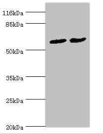 Polyclonal Rabbit anti-Human PDZD3 Antibody (IHC, WB)