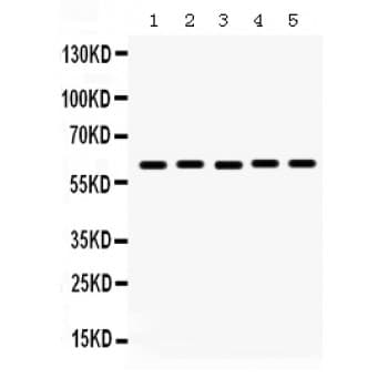 Polyclonal Rabbit anti-Human MAOA / Monoamine Oxidase Antibody (aa457-493, IHC, WB)
