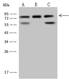 Dipeptidyl Peptidase 3 / DPP3 Antibody
