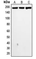 IHC-plus™ TOP2A / Topoisomerase II Alpha Antibody (N-Terminus)