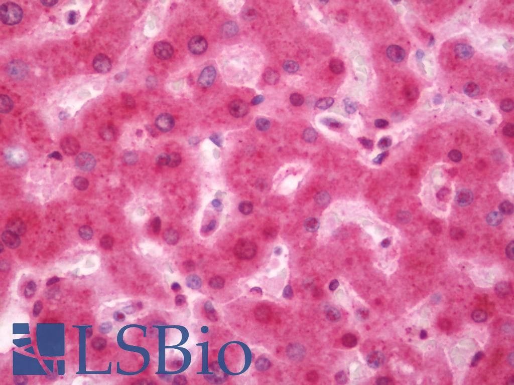 IHC-plus™ Polyclonal Rabbit anti-Human PH / PAH Antibody (aa351-400, IHC, WB)