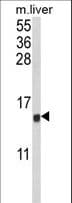 Polyclonal Rabbit anti-Human CCL3 / MIP-1-Alpha Antibody (aa59-87, IHC, WB)