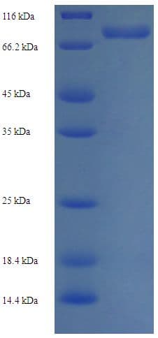 Human PPIL4 Protein (Recombinant His-SUMO)