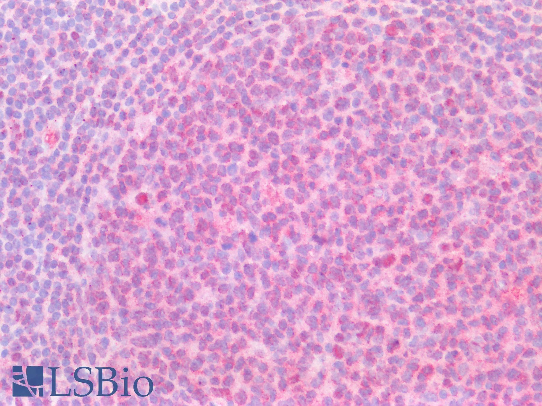 PathPlus™ Polyclonal Rabbit anti-Human SH2D2A Antibody (aa200-249, IHC, WB)