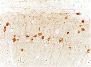 MTNR1A / Melatonin Receptor 1a Antibody